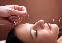 The Rise of Natural Healing: Acupuncture Services in Hollywood Explained Acupuncture Services in Hollywood