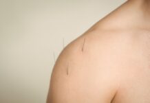 Top Benefits of Getting Acupuncture in Dublin for Stress, Pain & Sleep Issues Acupressure Treatment Services, Best Acupressure Treatment in Dublin