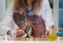 What Is the Best Treatment for Liver Disease Liver disease treatment